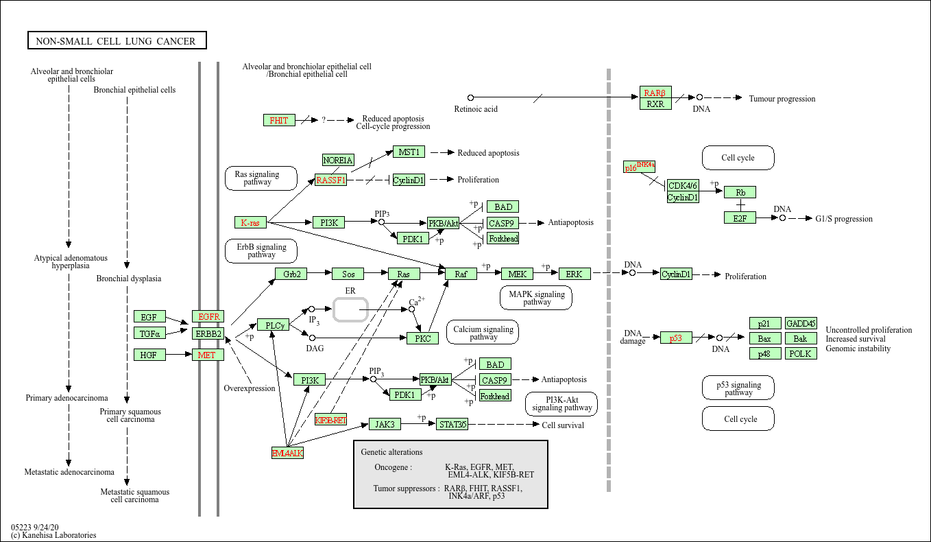 lung cancer cells diagram